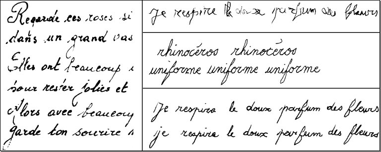 Exemples de R&eacute;&eacute;ducation graphique post-traumatisme